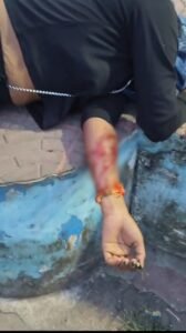 Point Blur Aug202025 092813