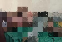 हाई वोल्टेज तार की चपेट में आया मजदूर , हालत गंभीर