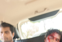 भूमि विवाद में खूनी संघर्ष: धान बोवाई के दौरान दो भाइयों पर कुदारी से हमला, सभी आरोपी गिरफ्तार