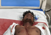 बिलासपुर: सिविल लाइन थाना लॉकअप में युवक ने ब्लेड से खुद को किया घायल, पुलिस जांच में जुटी