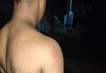 गेवरा खदान में चोरों के हौसले बुलंद: सीआईएसएफ जवान और एसईसीएल कर्मी पर हमला, मोबाइल और केबल लेकर फरार