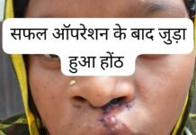 सफलता की कहानी,सफल सर्जरी से भीमे हेमला के चेहरे पर लौटी मुस्कान