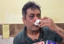 अंबिकापुर में कांग्रेस नेता और उनकी पत्नी पर जानलेवा हमला, 15-20 बदमाशों ने घर में घुसकर किया हमला