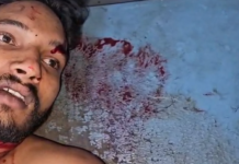 नशेड़ी बदमाश ने युवक के सिर पर कुल्हाड़ी से किया जानलेवा हमला, गंभीर हालत में अस्पताल में भर्ती