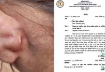 स्कूल में छात्रा से मारपीट के मामले में बाल अधिकार आयोग सख्त, DEO को भेजा नोटिस, 22 अक्टूबर तक मांगी जांच रिपोर्ट