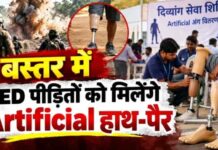 बस्तर में 3,000 लोगों को फ्री में लगाए जाएंगे कृत्रिम हाथ-पैर, माओवादी हिंसा में अंग गंवाने वाले की सहायता करेगी सरकार